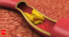 Blood Plaque Arteries Cholesterol Flow Heart