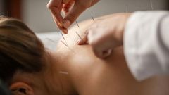 Acupuncture Endings Nerve Body Nerve Endings Areas